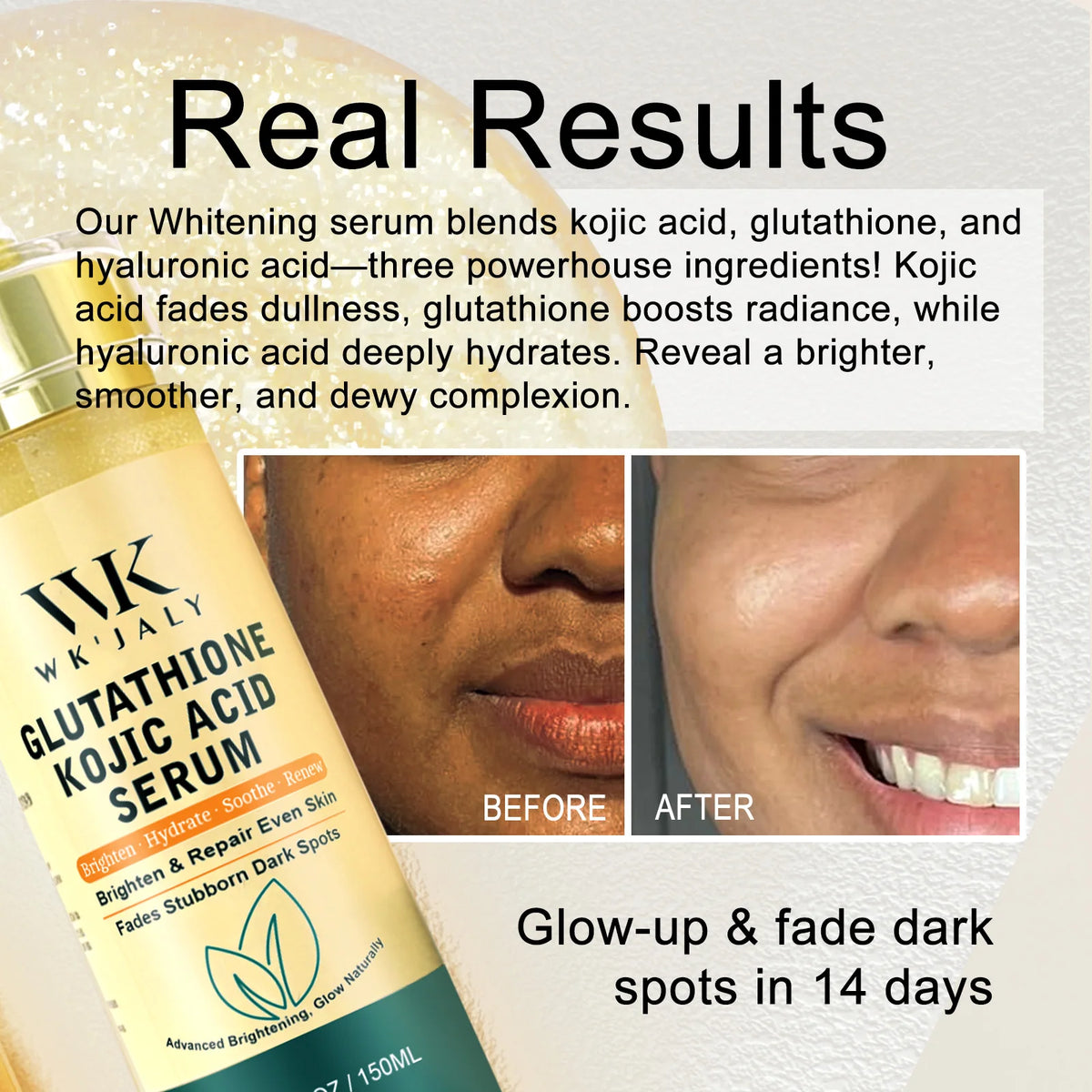 WK JALY Lightening Skin Care Kit for Dark, Black, Caramel Skin, Moisturizing, Acne and Spots Removal, Even Skin Tone for Women