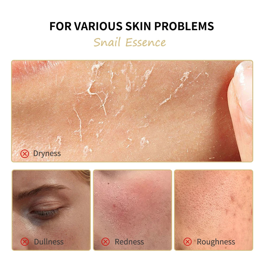 Revitalizing Snail Skincare Set Cleanser Serum Face Cream Mask Moisturizing Skin Barrier Repair Brightening Hydrating Facial Kit