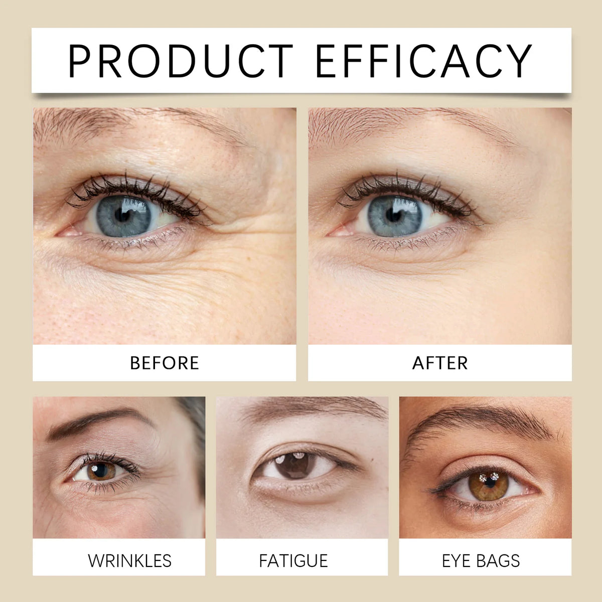 US Local JAYSUING Coffee Eye Cream 20g 360 Roller Rollerball Improve Dullness Anti Aging Anti Wrinkle Firm Skin Reduce Puffiness Daily Eye Care For Women